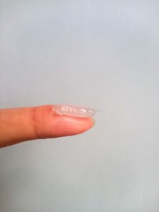 Eurax-Cream-10%-effect