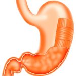 PPI-kidney
