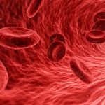Zyloric-Peripheral-arterial-disease