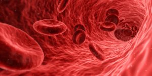 Zyloric-Peripheral-arterial-disease