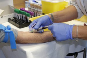 ギラン・バレー症候群におけるエクスリズマブの安全性と有効性に関する報告