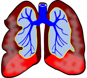 asthma-RELVAR-ELLIPTA