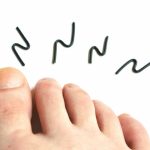 Athlete's foot-ointment-once-a-day