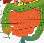 stress-irribow-effect