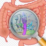 antibiotic-diarrhea