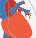 fluoroquinolone-aortic-aneurysm