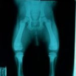 pelvic-floor-disorders