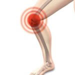 osteoarthritis-tramadol