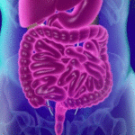 colorectal-cancer