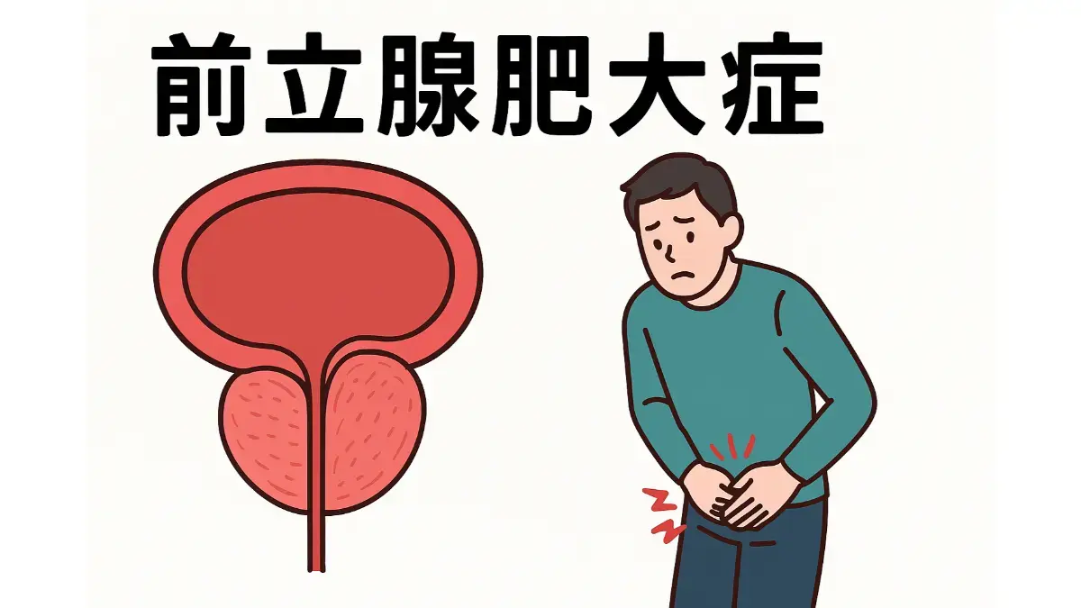 前立腺肥大症