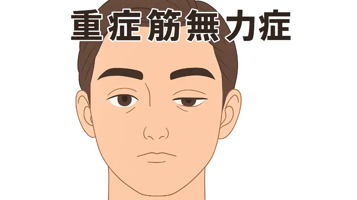 重症筋無力症