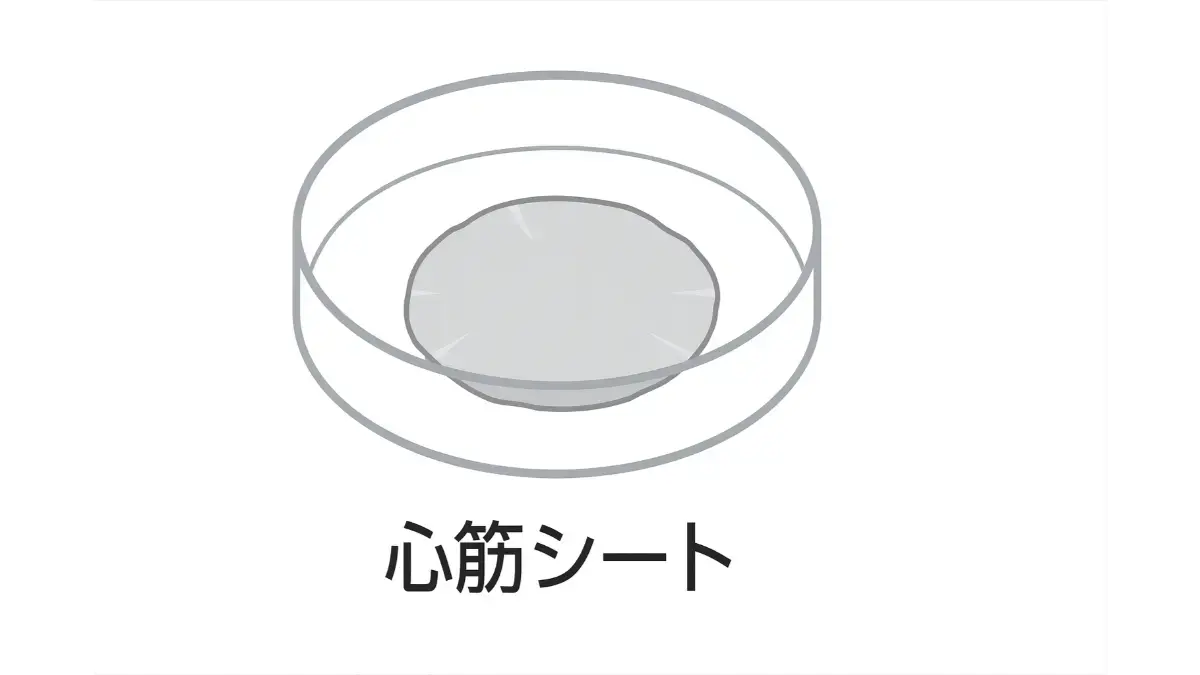 心筋シート