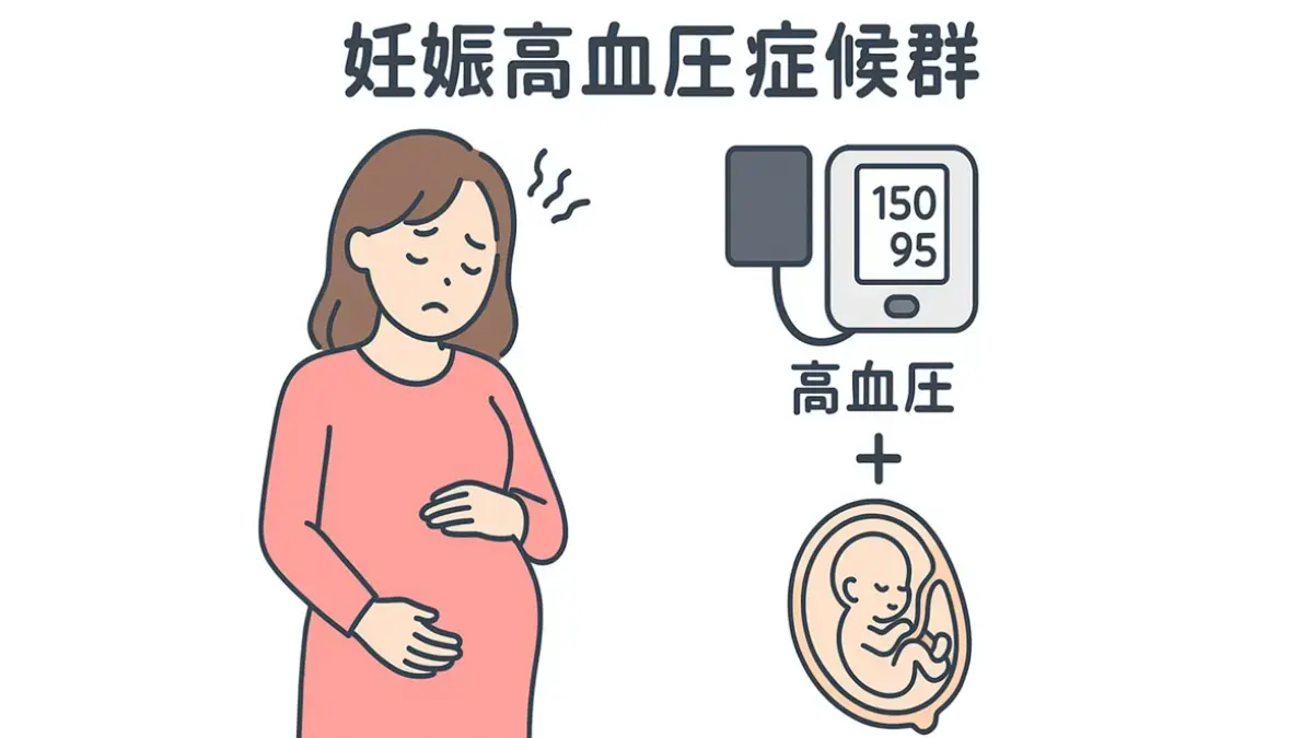 妊娠高血圧症候群