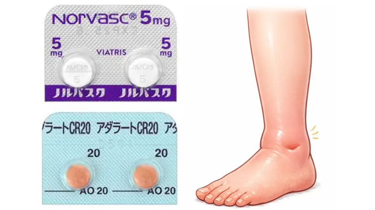 Ca拮抗薬と足の浮腫み