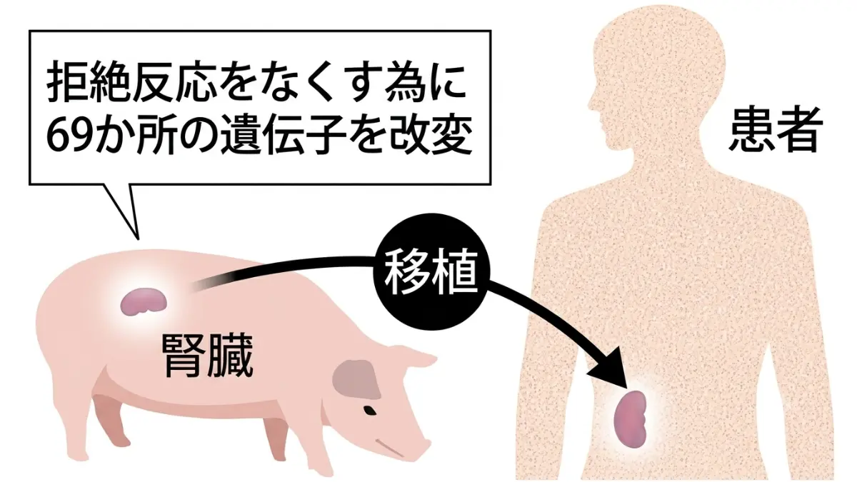 豚の腎臓を移植