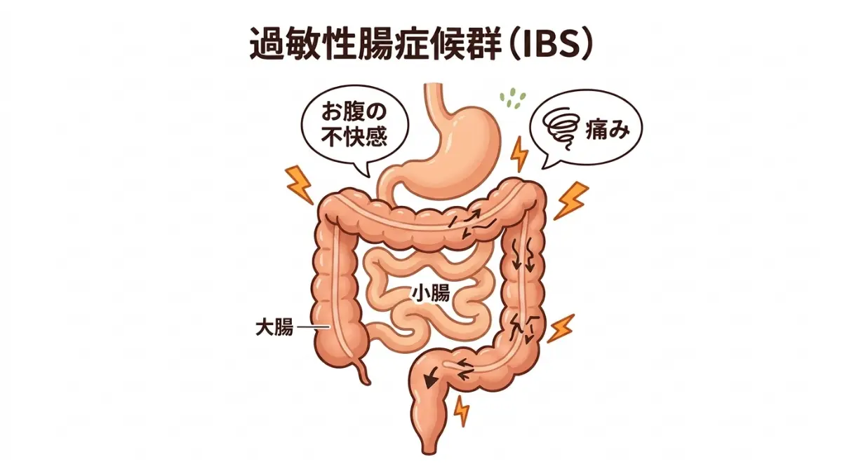 IBS過敏性腸症候群